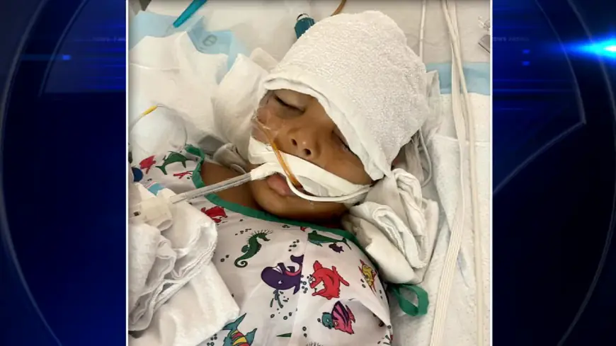 Family provides update on 5-year-old boy’s health after he fell from 4th-floor Little Havana apartment