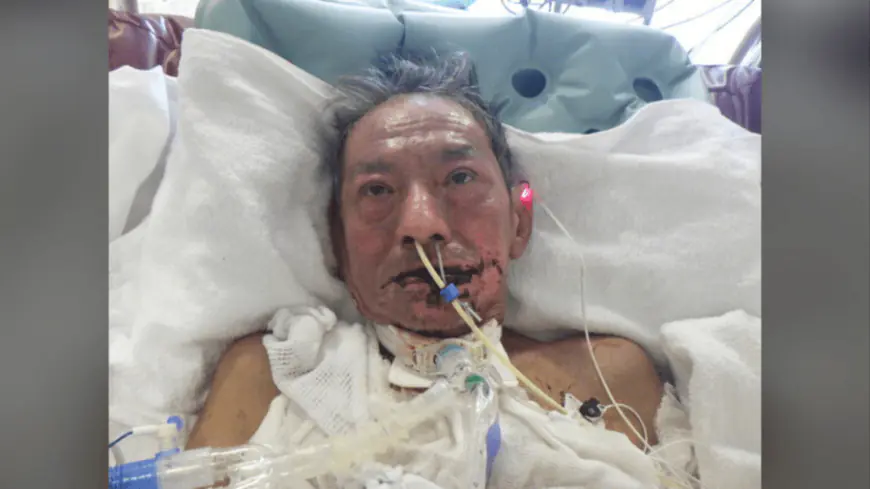 L.A. hospital needs help identifying injured man