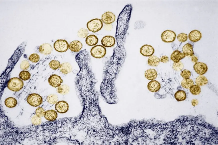 Gene Hackman's wife Betsy Arakawa died from hantavirus. But what is it?