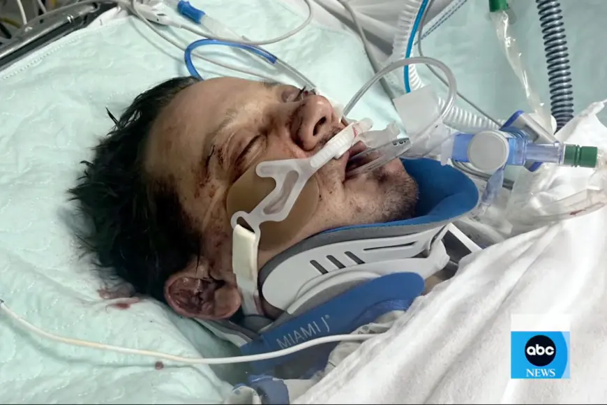 Jeremy Renner reveals horror of being run over by snow plow: ‘I heard all the bones crack’ and ‘I could see my left eye with my right eye’